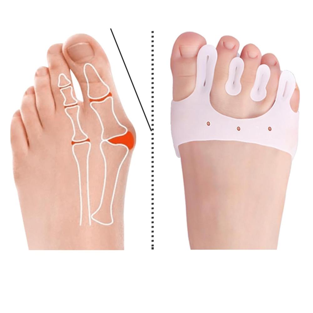 3 Pairs Five-Hole Metatarsal Pads - Silicone Foot Pads for Toe Alignment, Pain Relief & Comfort for Metatarsalgia, Neuroma & Bunions