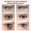 Crema para Ojos con Niacinamida Elimina Ojeras Bolsas debajo de los Ojos Suero Hidratante con Ácido Hialurónico Contra la Hinchazón Gel para el Cuidado de los Ojos