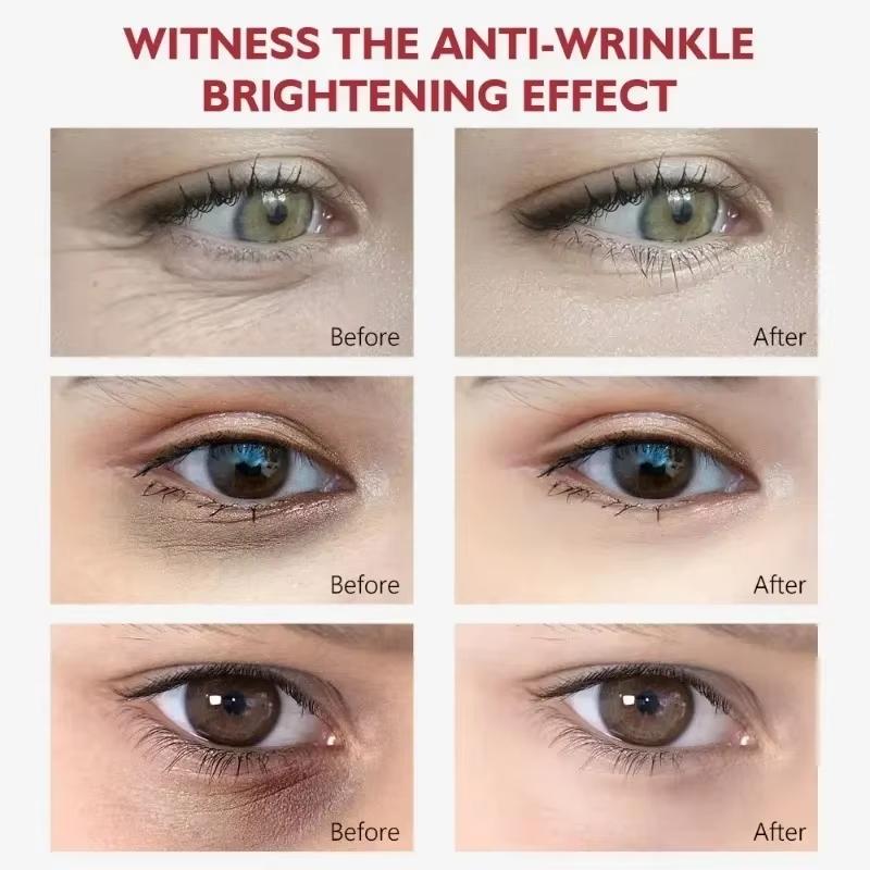 Crema para Ojos con Niacinamida Elimina Ojeras Bolsas debajo de los Ojos Suero Hidratante con Ácido Hialurónico Contra la Hinchazón Gel para el Cuidado de los Ojos