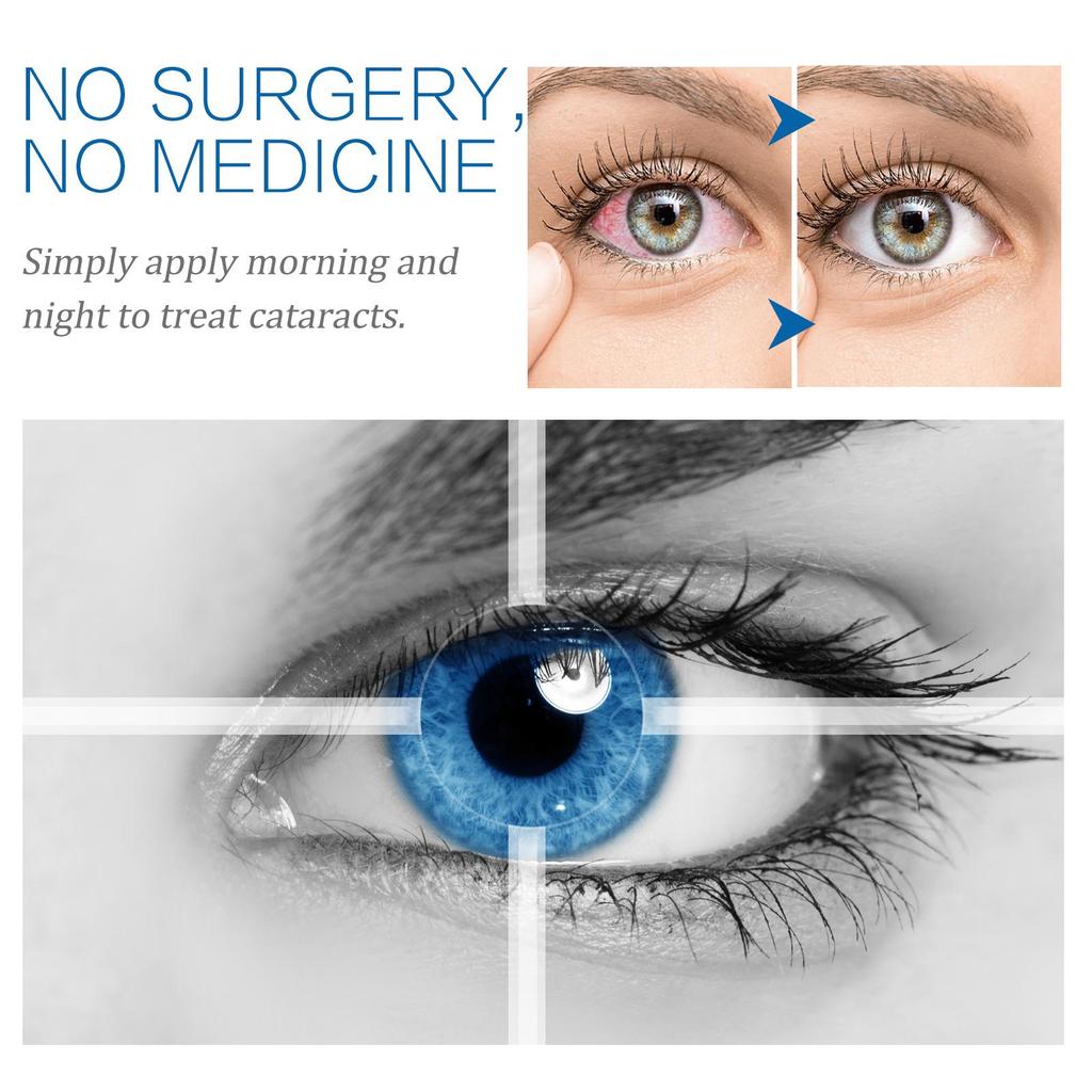 South Moon Zeder Augen-Gel Kühlende Behandlung, Glycerin + Propylenglycol Dual-Action Hydrationsspeicher, Anti-Falten Augenpflege 20g