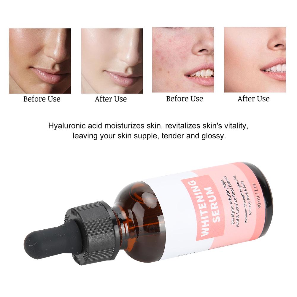melao whitening serum