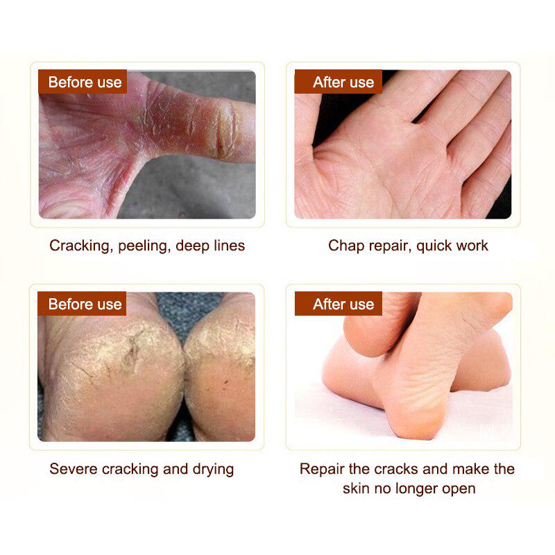 Moisturizing Repair Hand Foot Cream Anti-Aging Horse Oil Skin Whitening Nourishing Hydrating Hand Cream Hand Care