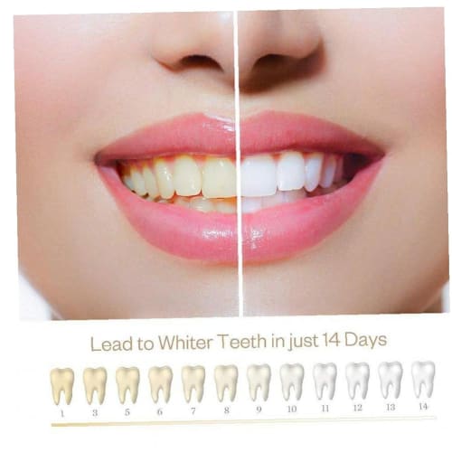 1pc Teeth Whitening Pen, Teeth Whitening Gel, Bleaching Gel, Whitener, Removes Stains, Toothpaste Pen, Oral Hygiene, Dental Care