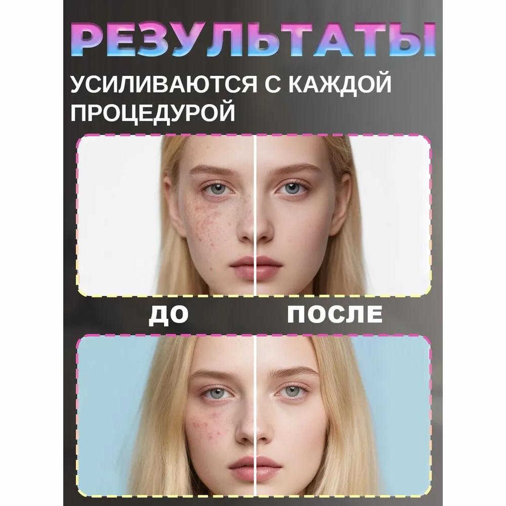 LED face mask LED rejuvenation device