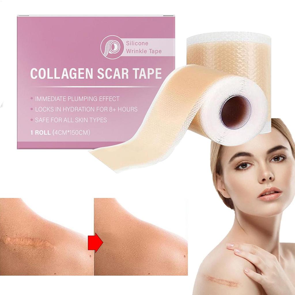 Scar Sheets 1 Roll Self-Adhesive Scar Cover Tape Skin Care Waterproof and Breathable
