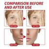 Wrinkle Remove Cream Anti-Aging Fade Fine Lines Firming Lifting Skin Fade Dark Spots Freckle Melanin Treatment Face Repair Cream