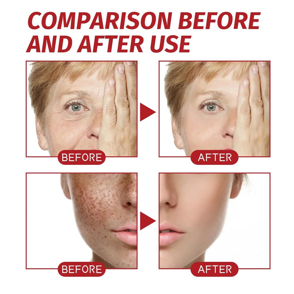 Wrinkle Remove Cream Anti-Aging Fade Fine Lines Firming Lifting Skin Fade Dark Spots Freckle Melanin Treatment Face Repair Cream