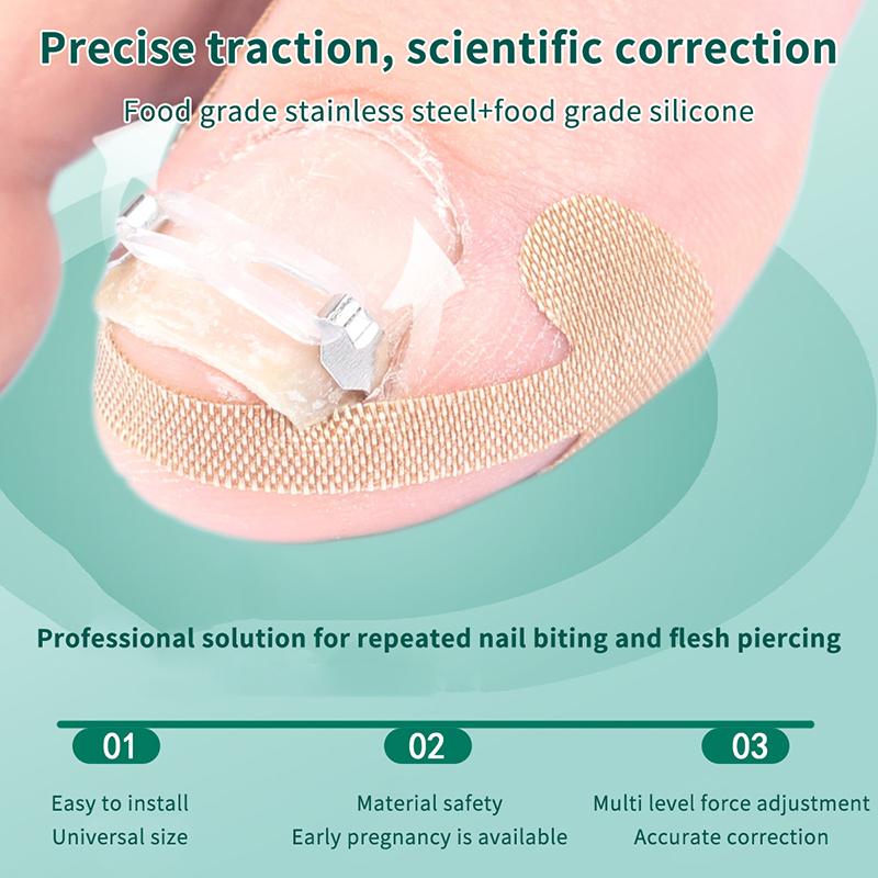 1/2 Set Ingrown Toenail Corrector Tools Pedicure Recover Embed Toenail Treatment Professional Foot Care Correction Tool