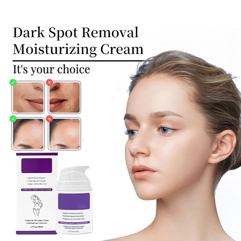 Feuchtigkeitsspendende Körpercreme reduziert Mattheit unter den Achseln, an Knien und Ellbogen und hellt den Teint auf.