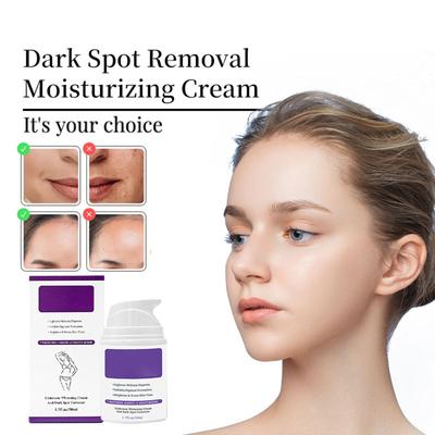 Moisturizing Body Cream Reduces Dullness Under The Armpits, Knees And Elbows, And Brightens The Complexion