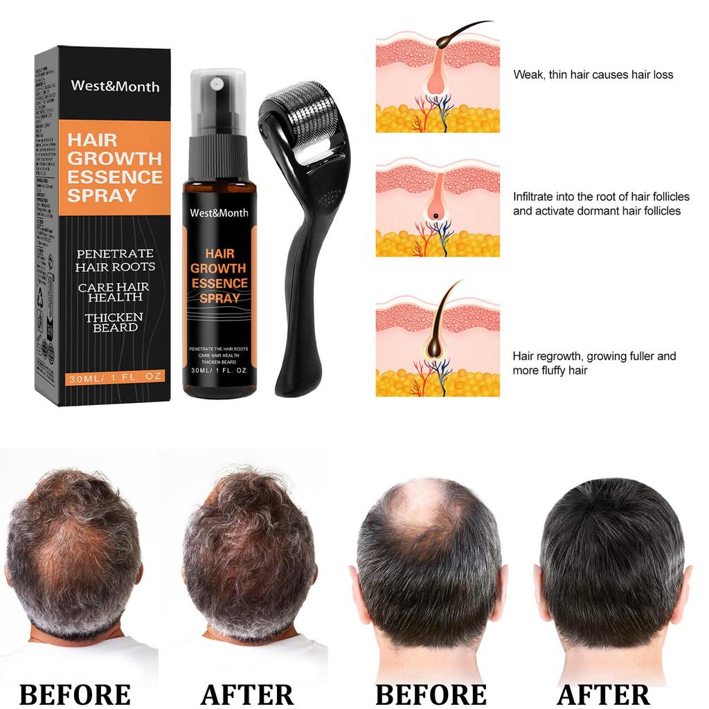 Siero Capelli Anti-Caduta con Polygonum Multiflorum & Zenzero, Spray per la Crescita dei Capelli per Capelli più Folti & Cura della Linea dei Capelli