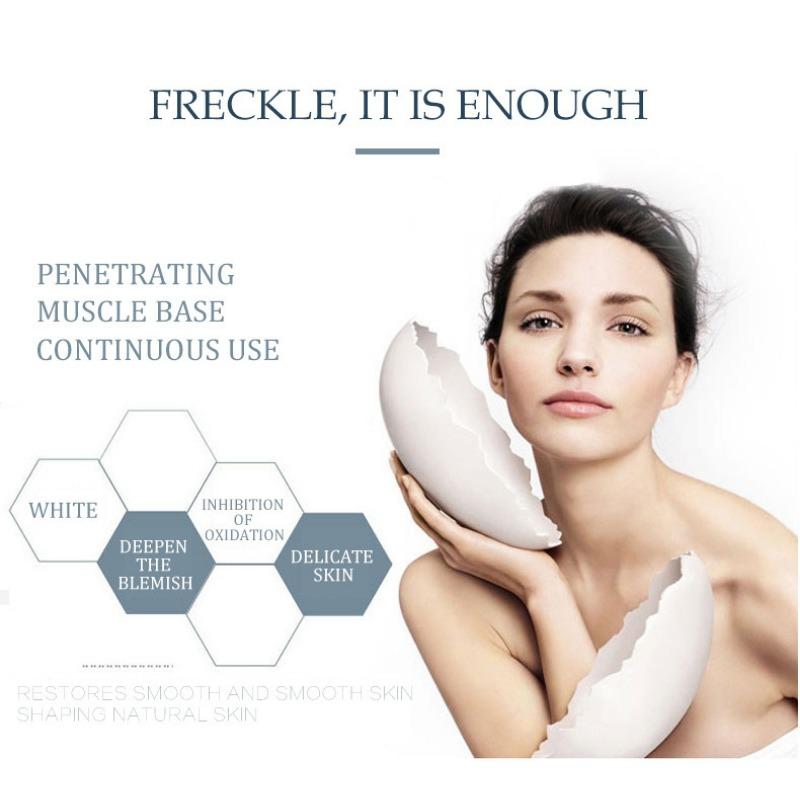 Whitening and Freckle Removing Cream Fading and Gentle Freckles Removing Freckle Age Freckle Melasma Repair Cream