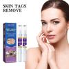 Eelhoe Body Mole Removal Pen Effective Skin Tag Remover For Face Hands And Neck