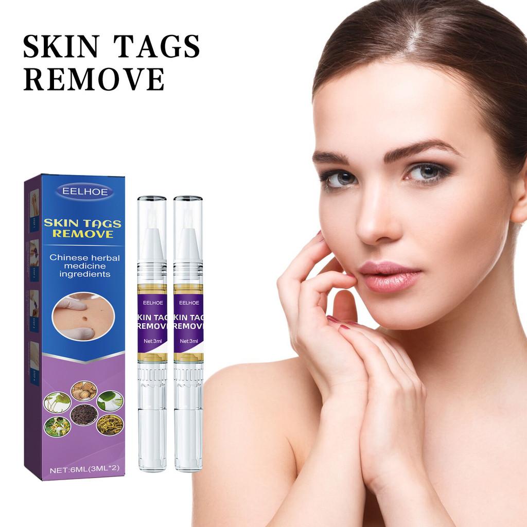Eelhoe Body Mole Removal Pen Effective Skin Tag Remover For Face Hands And Neck