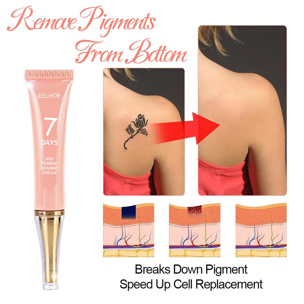  Removal  Permanent Removal Of s  Removal 