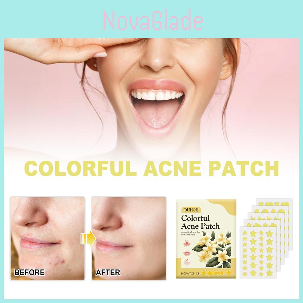 Ouhoe Yellow Acne Patches For Gentle Skin Repair And Effective Pimple Treatment With Oil Control And Hydration 140 Pieces