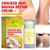 Jaysuing Moisturizing Foot Cream For Deep Hydration And Skin Repair For Cracked Dry Feet