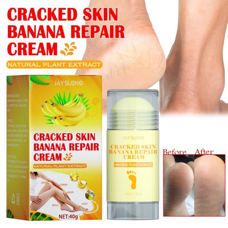 Jaysuing Moisturizing Foot Cream For Deep Hydration And Skin Repair For Cracked Dry Feet
