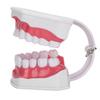 Modelo de dentes de ensino odontológico 2X Modelo de dentes de ampliação Ferramenta de treinamento de ensino de dentista