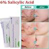 Salicylic Acid SF6 Pore Shrinking Cream (50g), Quick Elimination Large Pores Remove Blackehead Tighten Face Smooth Skin Care Product