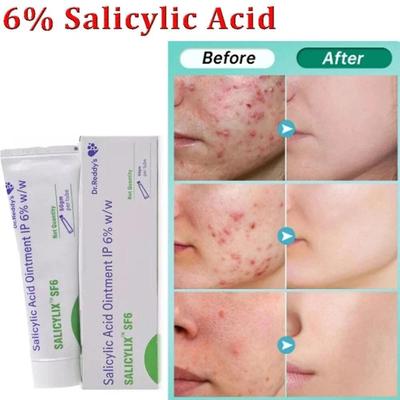 Salicylic Acid SF6 Pore Shrinking Cream (50g), Quick Elimination Large Pores Remove Blackehead Tighten Face Smooth Skin Care Product