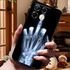 Für Infinix Note 40 Pro Hülle 4G 5G Mode Weiches Silikon TPU Rückseite Für Infinix Note 40 4G Handyhülle Coque Note40 Pro 5G
