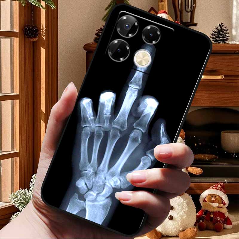 Für Infinix Note 40 Pro Hülle 4G 5G Mode Weiches Silikon TPU Rückseite Für Infinix Note 40 4G Handyhülle Coque Note40 Pro 5G
