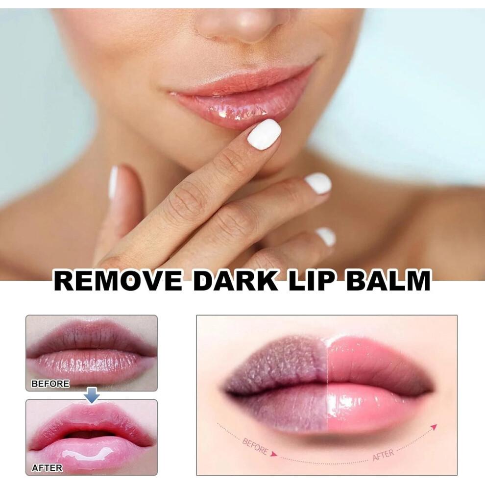 Lip Acne Cream, Fordyce Seeds - Lip Acne, Moisturizes, Improves Dry