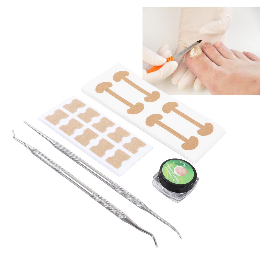 Ingrown Toenail Treatment Kit Toenail Correction Patch C Type Strips Nail File Lifter Pedicure Tool Kits
