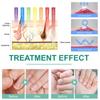   Nail Fungus Light Therapy Device Nail Fungus Treatment Lamp Nail Fungus Removal Device