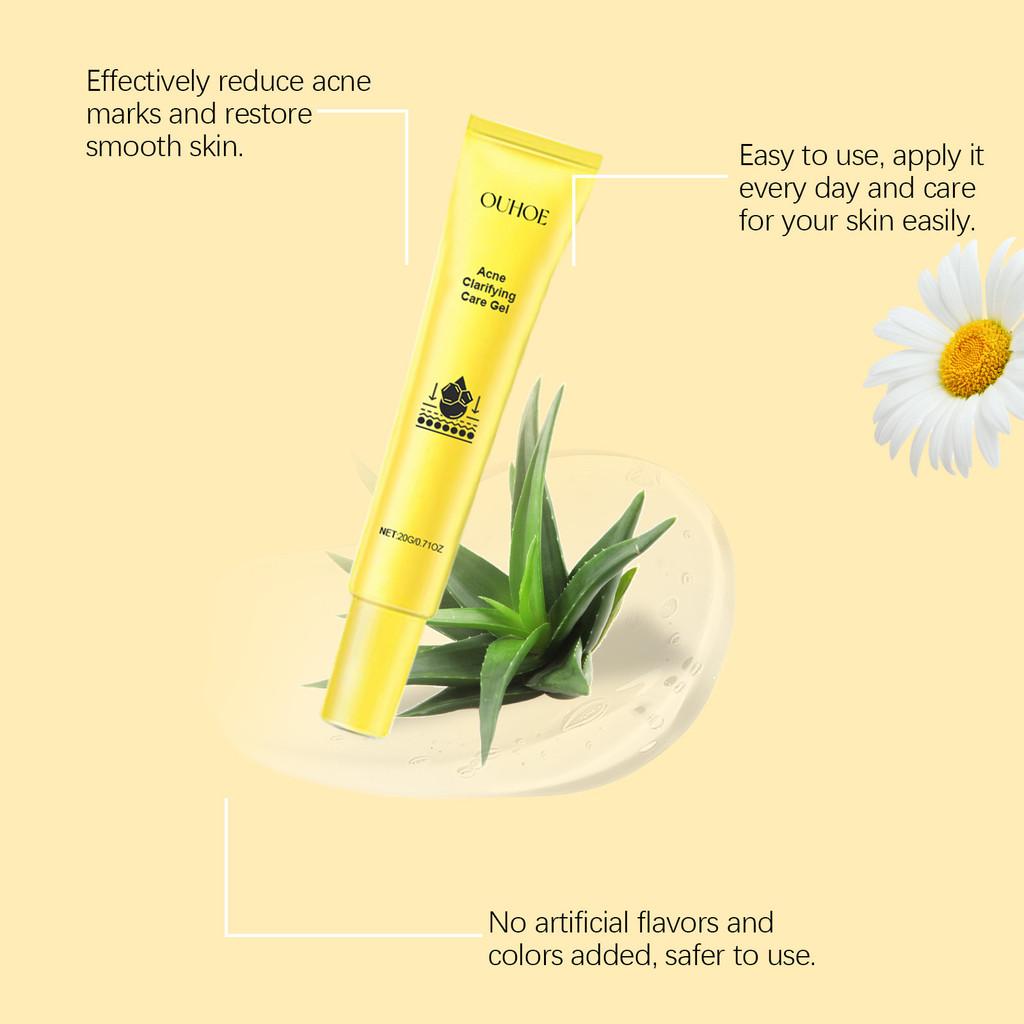 Ouhoe Acne Gel For Deep Cleansing And Brightening Skin With Pore Minimizing Formula 20g