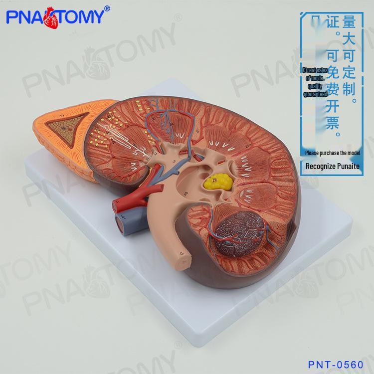 Magnified Human Kidney & Adrenal Gland Model for Urinary and Reproductive System Study 27x20x10 cm