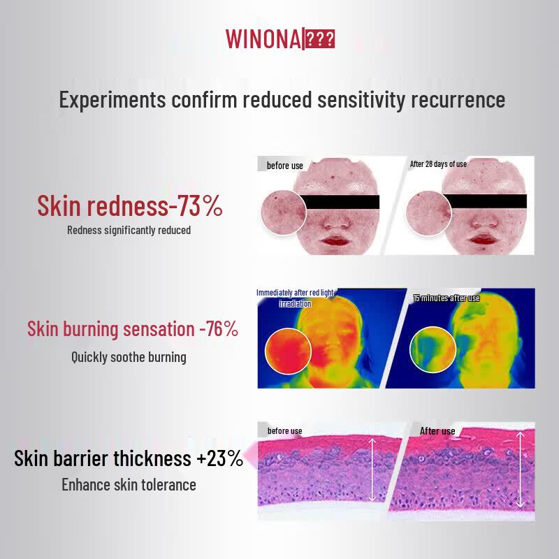 WINONA Soothing and Moisturizing Special Cream
