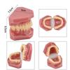 Neues Dental-Erwachsenenmodell Harz Normale Zahnmedizin Medizinisches Zahnmodell Studieren Lehren Bildung Mund-Zahn-Produkte