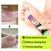 Herbal Athlete's Foot Care Balm 20 G, Effectively Treats Foot Odor, Itchy Feet, Rotten Feet And Athlete's Foot, And Moisturizes And Protects Dry