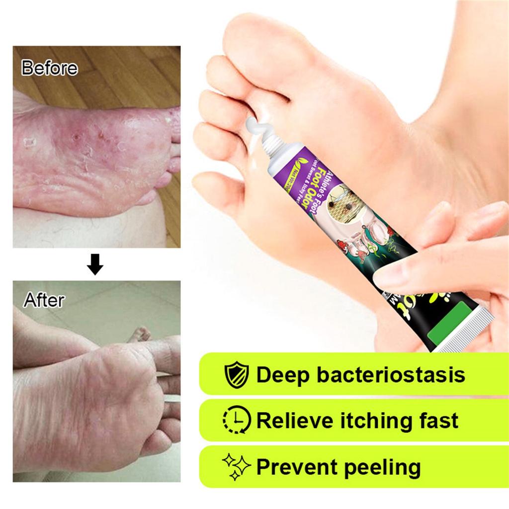 Bálsamo herbal para el cuidado del pie de atleta (20 g). Trata eficazmente el mal olor de pies, la picazón, los pies podridos y el pie de atleta, además de hidratar y proteger la piel seca.