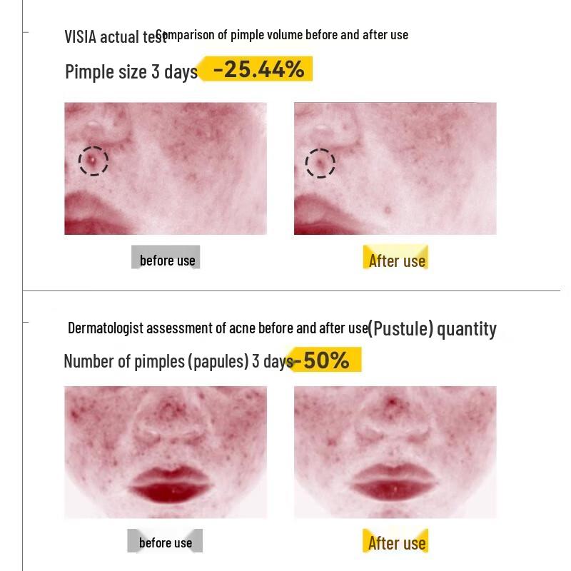 

Yu Mei Jing Teen Oil Control Balancing Emulsion