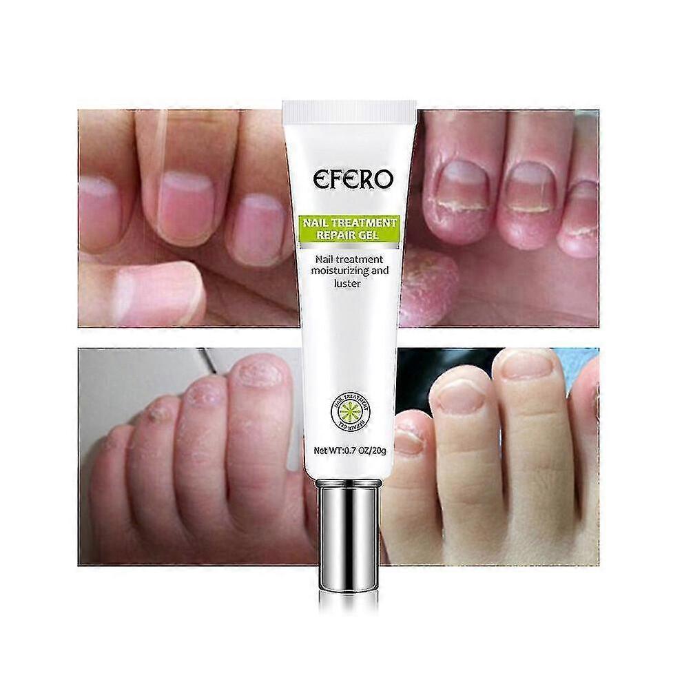 3x Efero Nagelpeeling Pflanzen-Nagelreparatur-Flüssigkeit Nagelcreme Nagelpflege-Gel Nagelreparatur-Gel Feuchtigkeitsspendender Nagelglanz Tw