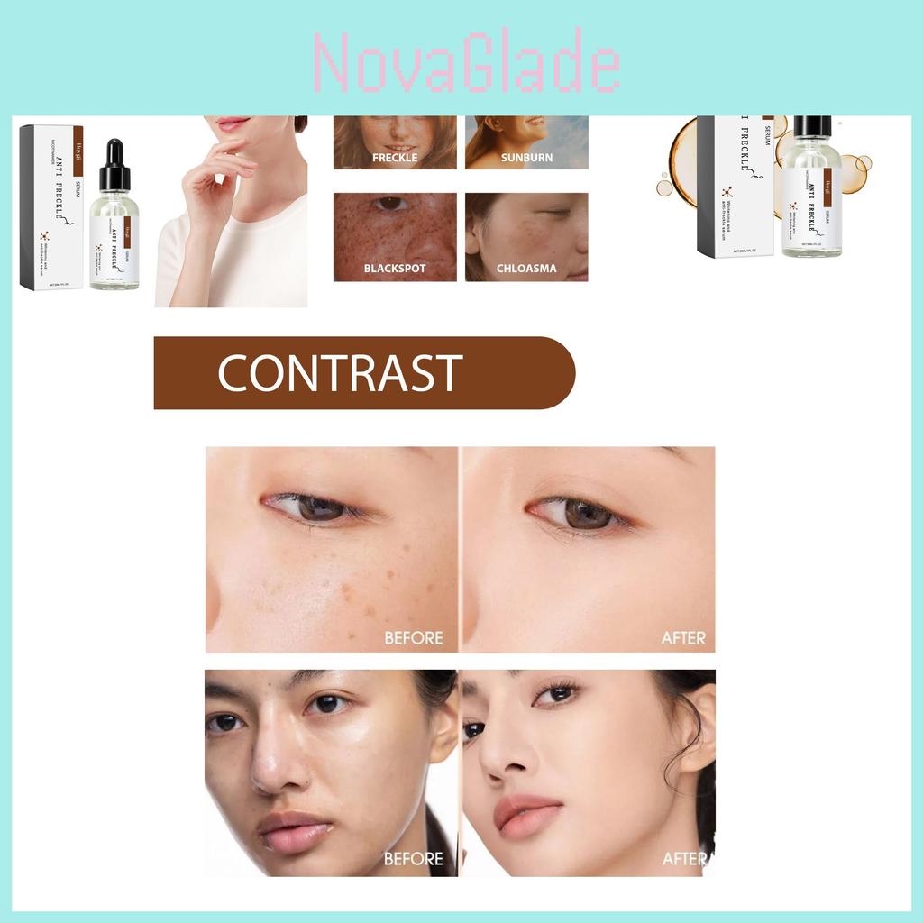 Hoygi Niacinamide Spot Brightening Serum Hydrating And Nourishing Skin Treatment For Dark Spots And Dull Complexion