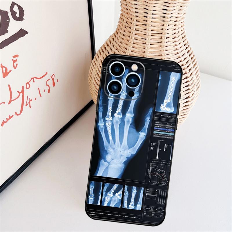 Radiological Human Organs Skeleton Cover Case For iPhone 14 Pro 11 16 15 Pro Max 12 13 Mini Plus XS X XR Funda