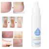 Moisturizing Foot Care Dead Skin Horniness Removal Spray Foot Callus Softener 80ml