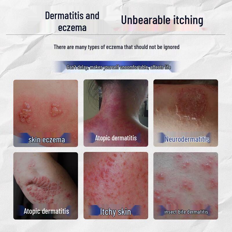 Jiubu Pharmaceutical Multi-Purpose Itch Relief Cream