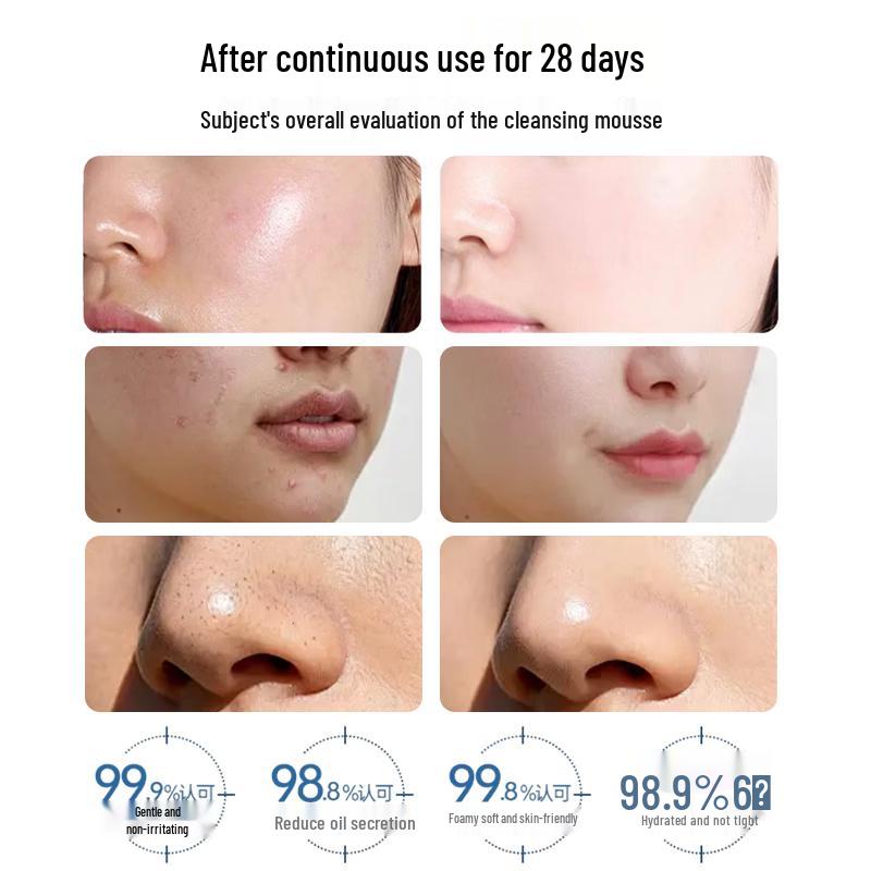 HIEUAILR Amino Acid Teenage Facial Cleanser