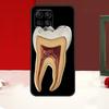 Human Tooth Anatomy Case For Samsung Galaxy M14 M34 M54 M13 M53 M56 M52 M32 M16 M11 M21 M31 M35 M12 M15 M36 M55
