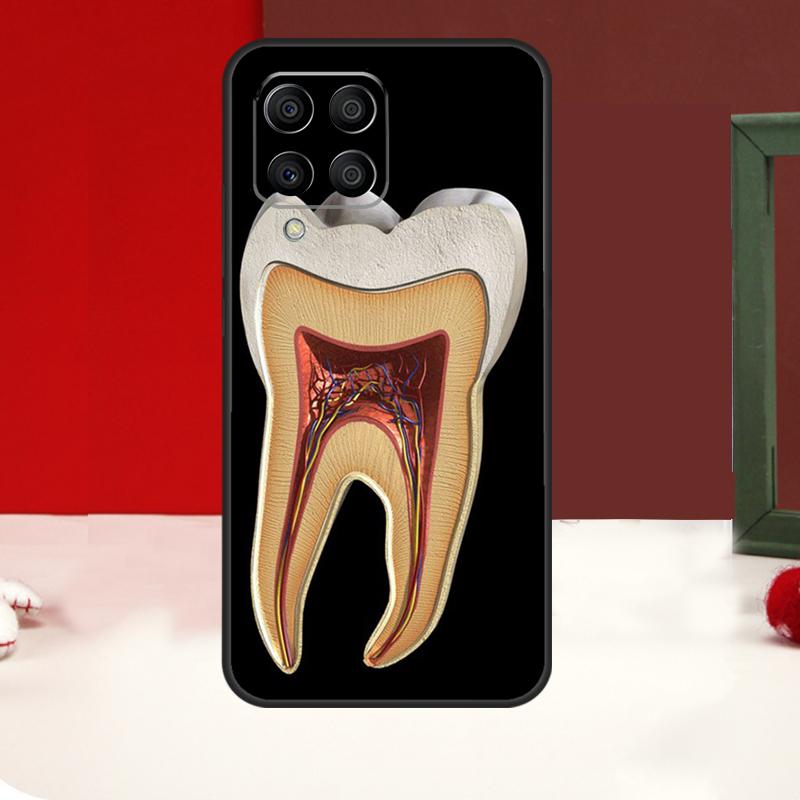 Human Tooth Anatomy Case For Samsung Galaxy M14 M34 M54 M13 M53 M56 M52 M32 M16 M11 M21 M31 M35 M12 M15 M36 M55