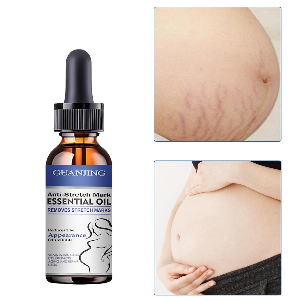 5ML/15ML/30ML/50ML/Abdominal Massage Oil for Removing Stretch Marks, Moisturizing and Hydrating Massage Oil