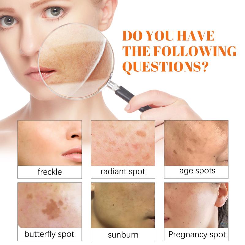 Papaya Freckle Cream Pigmentation Control for Face Moisturizing Brightening Day Cream for Dark Age Spots