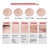 1 Set Remove Dark Mole Face Cleaner Skincare Tool 220V Electronic Spot Scanner Dead Skin Removal Beauty Device Blackhead Remover
