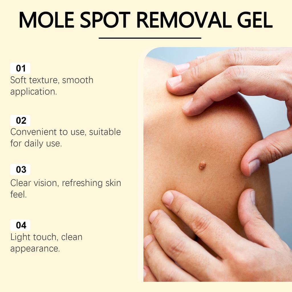 Freckle Removing Nevus Gel Whitening And Rejuvenating Skin Lightening Sun Freckle Brightening Skin Cream