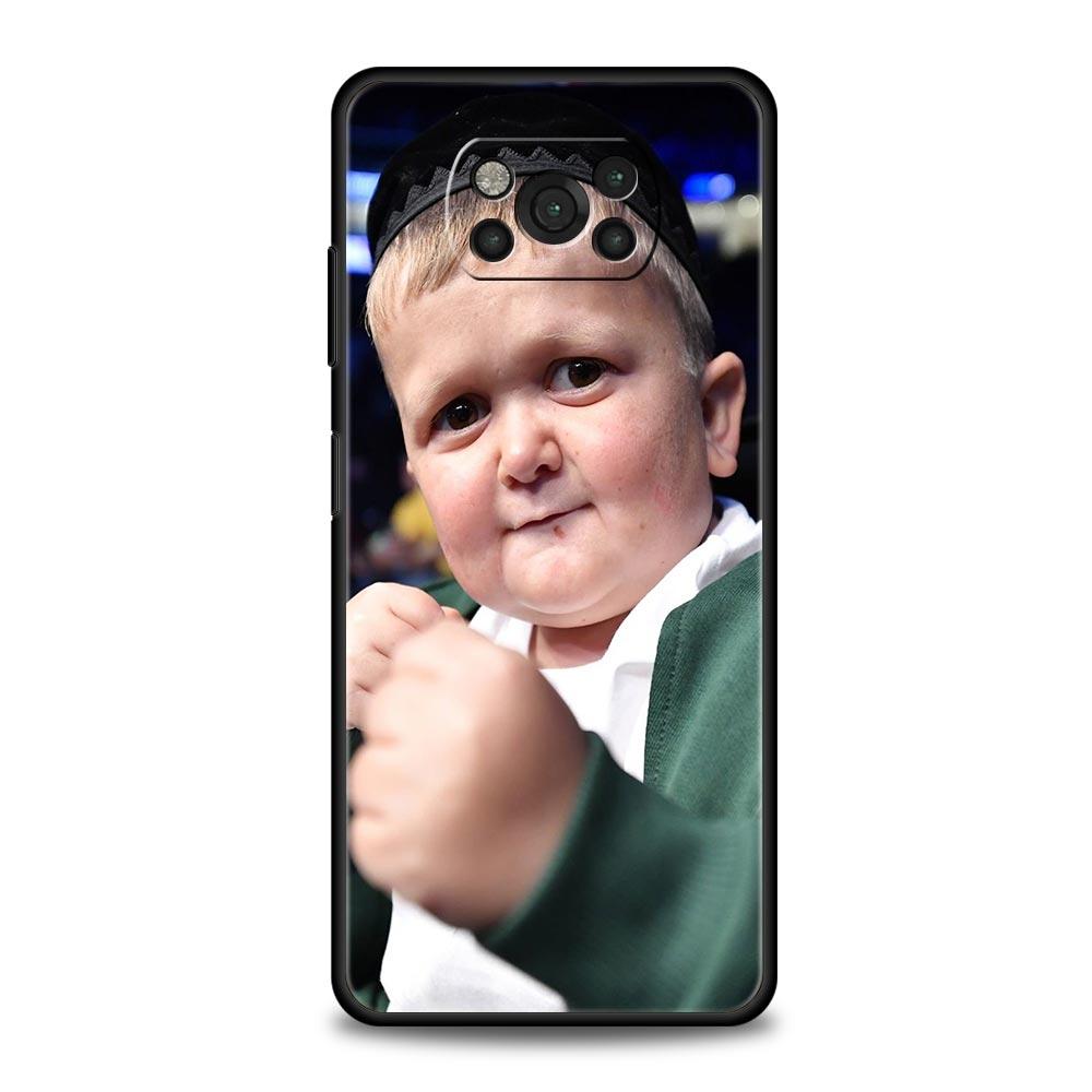 Funny Hasbulla Phone Case For Xiaomi Mi Poco X3 NFC M3 F4 F3 M4 X4 Pro 5G Note 10 12 Lite 11 11T 10T 11X 13 12T Pro 9T Cover